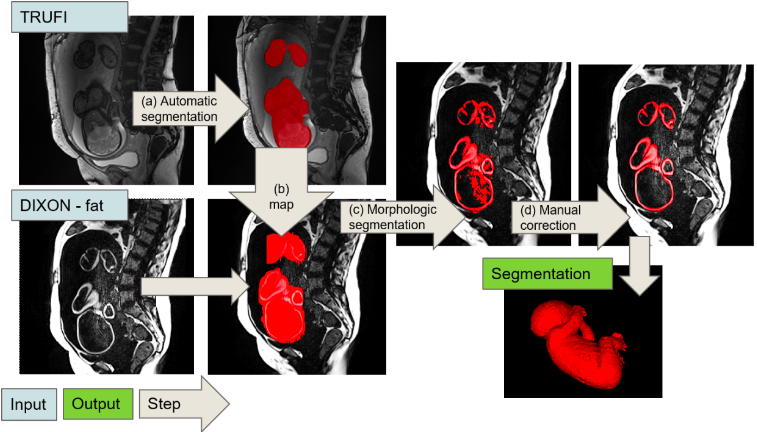 fbdnn fetal health figure